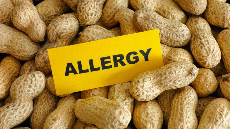 A layer of peanuts with a yellow sign with the word allergy written on it.
